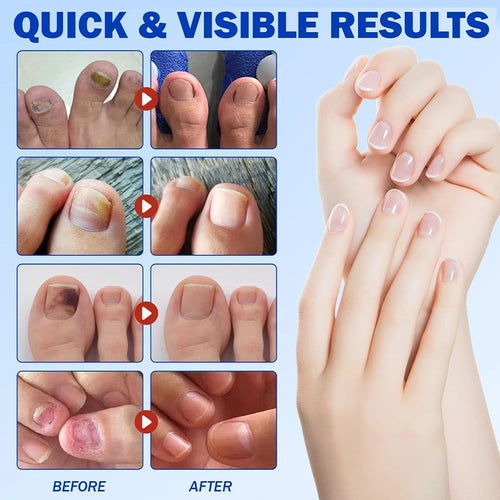 FUNGAL REPAIR PATCH